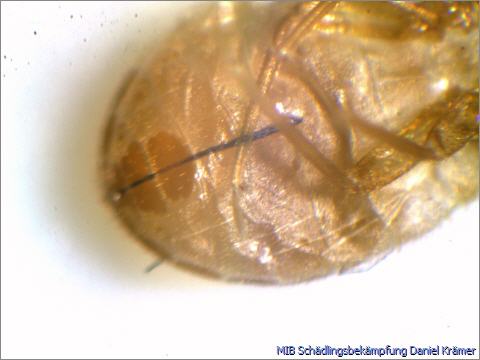Der hintere Teil einer Bettwanzenhülle (Häutungsrest) unter dem Mikroskop.